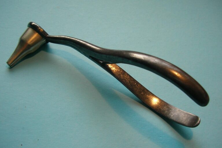 Spreizbare Ohrspekula HNO-Nachrichten - Ein medizitechnischer Irrweg