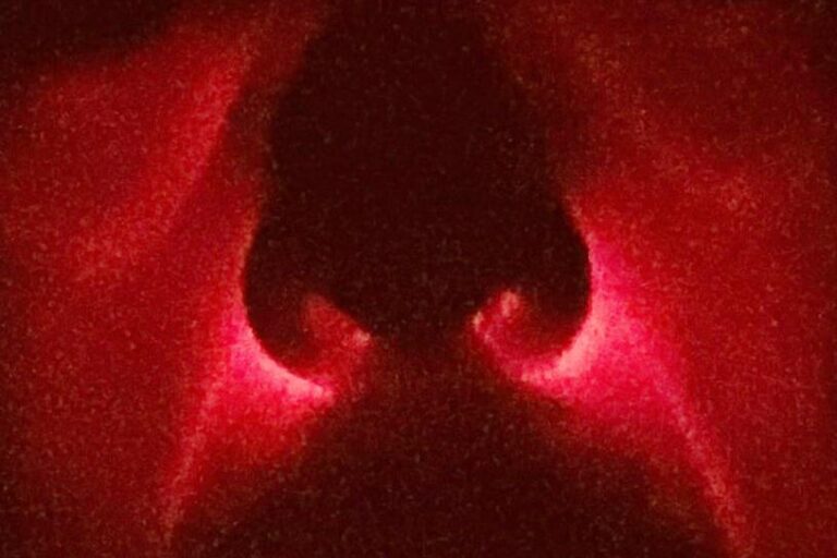 Die Diaphnoskopie der Nasennebenhöhlen